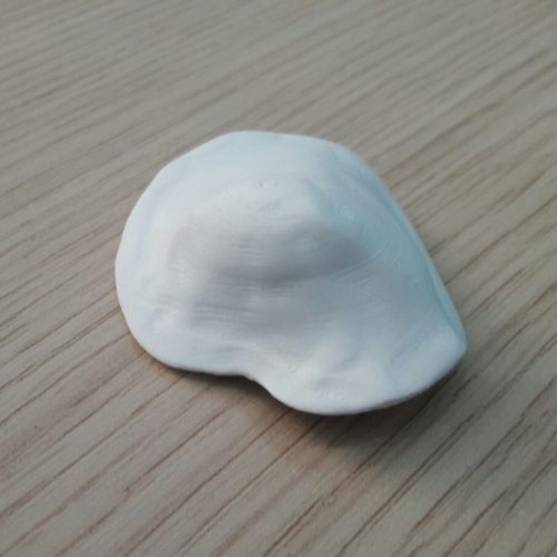 Protezione per bulbo oculare